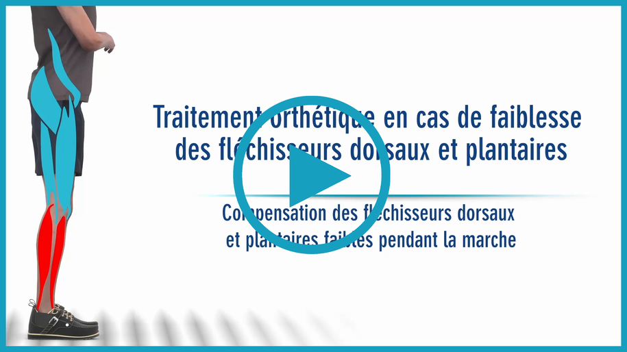 Vidéo d’explication des fonctions des fléchisseurs plantaires et dorsaux avec conséquences sur la marche et correction par une orthèse tibio-pédieuse AFO dynamique sur mesure avec mécanismes de ressort précomprimés en butée dorsale et en butée plantaire NEURO SWING Carbon