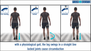comparaison du fonctionnement d’une orthèse KAFO en vue de côté avec articulation de genou à mouvement libre, verrouillée et automatique stabilisant la phase d’appui SCO au milieu de la phase oscillante circumduction mouvement non naturel du buste