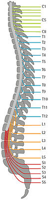 colonne vertébrale pour représenter le niveau de lésion dans la moelle épinière et les voies nerveuses après une paraplégie lésion médullaire et détermination de la limitation due à la paralysie et possibilité de traitement avec un dispositif médical orthèse