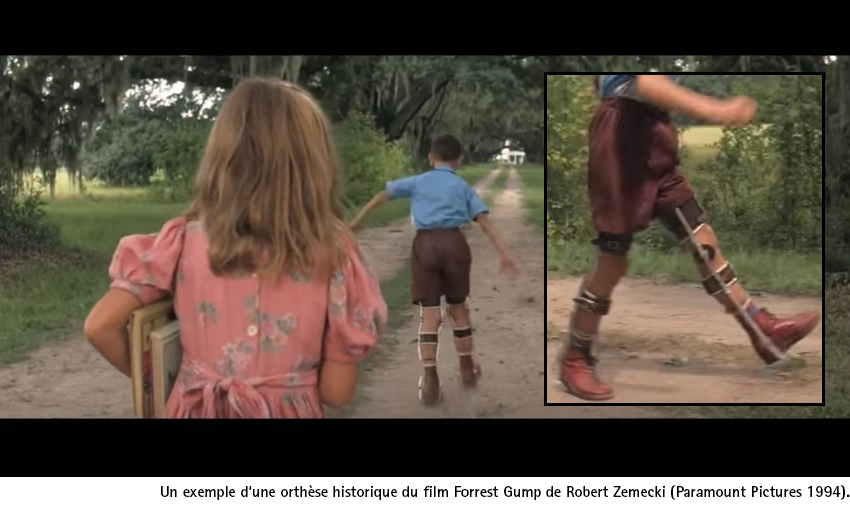 Forrest Gump avec KAFO historique orthèse orthèses montre une ancienne orthèse montants-embrasses qui représente encore un trouble de la marche au lieu d’une aide